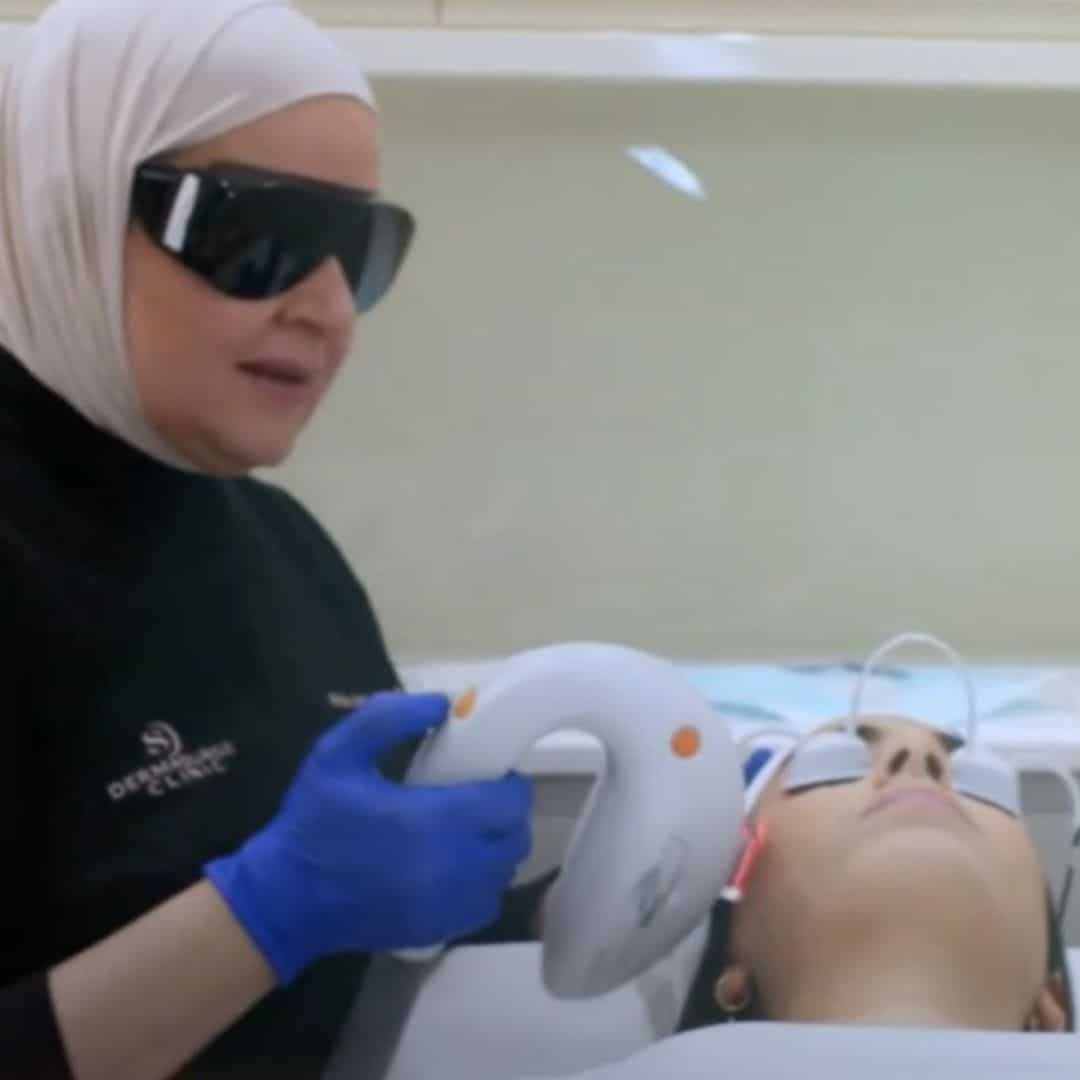 Dr Injibar photofractional skin rejuvenation treatment