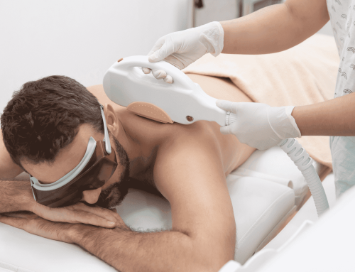 5 Key Benefits of Laser Hair Removal