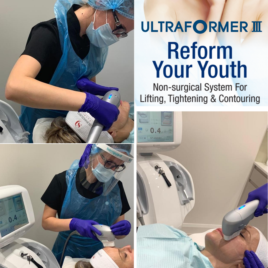 ultraformer 3 treatment at dermasurge